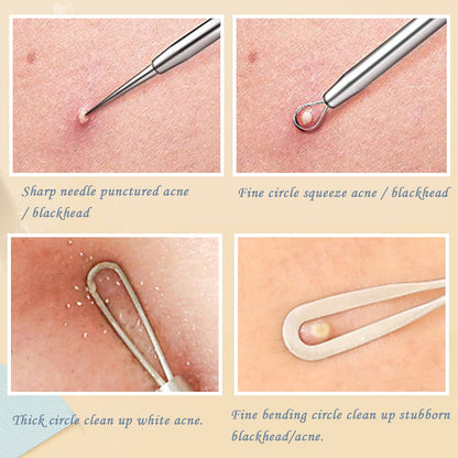 Blackhead Remover Pimple Popper Tool Kit, 6-In-1 Blackhead Comedone Acne Blemish Pimple Extractor Tool Kit Tweezers Kit Skin Care Tools for Face Health & Beauty > Personal Care > Cosmetics > Cosmetic Tools > Skin Care Tools SKINOSM   