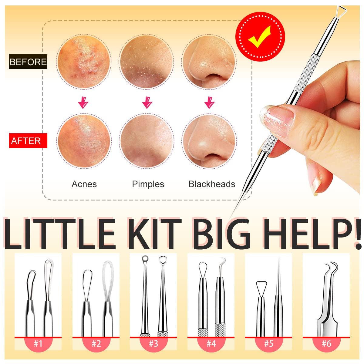 Blackhead Remover Tools, Pimple Popper Tool Kit, 6 Pack Professional Comedones Extractor Acne Removal Kit for Blemishs, Whitehead Popping, Zit Removing for Nose Face - with Organized Case Health & Beauty > Personal Care > Cosmetics > Cosmetic Tools > Skin Care Tools Cbiumpro USA Co.,Ltd   