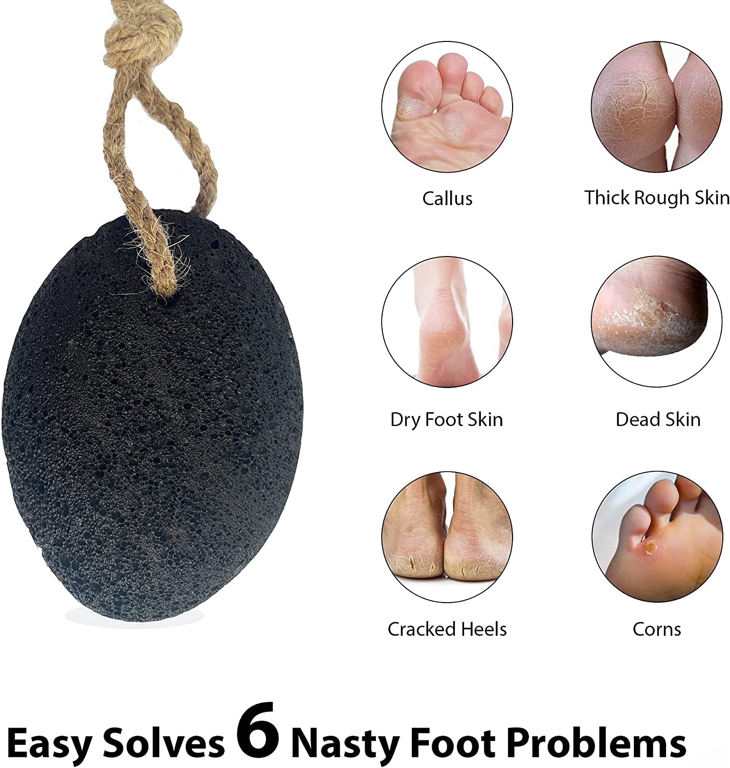 Foot Pumice Stone by VNI Stone - Natural Earth Lava Pumice Stone for Feet Callus Removal- Callus Warts Corn Removal - Pedicure Exfoliator for Dry Dead Skin, Heels, Palm - Healthy Foot Care Scrubber Health & Beauty > Personal Care > Foot Care VNI Stone   