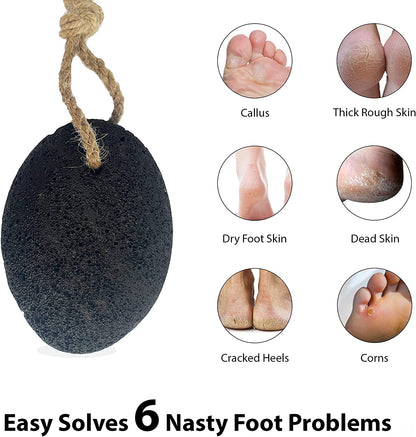 Foot Pumice Stone by VNI Stone - Natural Earth Lava Pumice Stone for Feet Callus Removal- Callus Warts Corn Removal - Pedicure Exfoliator for Dry Dead Skin, Heels, Palm - Healthy Foot Care Scrubber Health & Beauty > Personal Care > Foot Care VNI Stone   