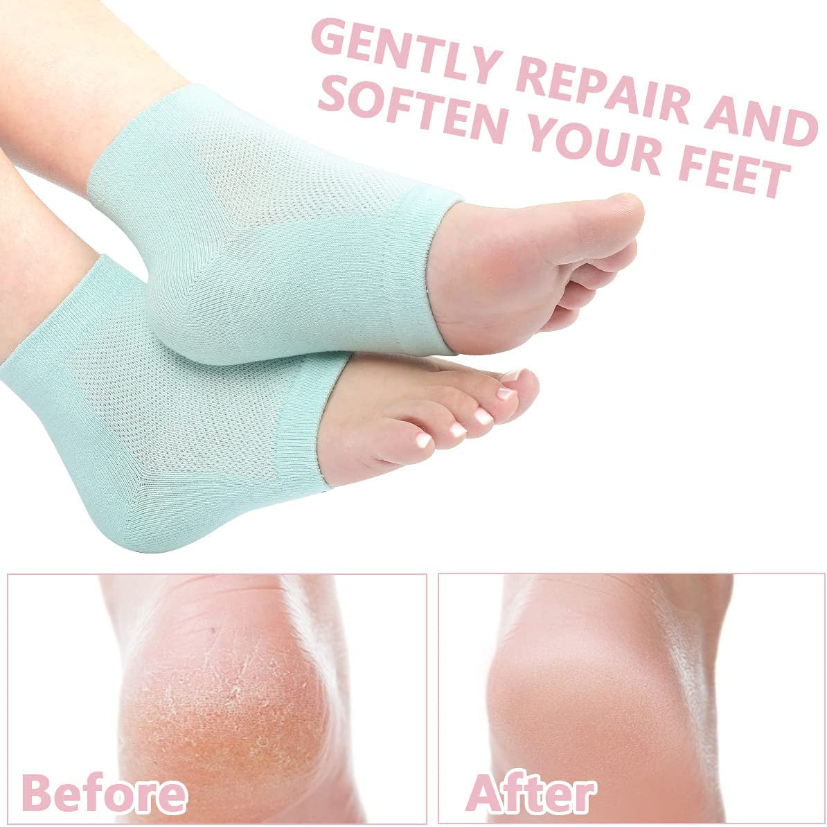 Moisturizing Heel Gel Socks - Heal Dry Cracked Dead Skin Foot Care Softener Pedicure Spa Sock Set | 4 Pairs Soft Silicone Lotion Ankle Sleeves to Repair Eczema Callus Rough Pain Relief Treatment Health & Beauty > Personal Care > Foot Care YOTURO   