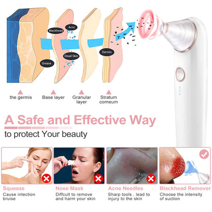 Blackhead Remover Pore Vacuum,Acne Remover,Comedone Whitehead Extractor Tool-3 Suction Power,4Probes,Usb Rechargeable Blackhead Vacuum Kit for Women & Men Health & Beauty > Personal Care > Cosmetics > Cosmetic Tools > Skin Care Tools eulumap   