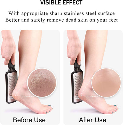 Setsail Foot File Callus Remover Metal Surface Foot Scrubber Premium Stainless Steel Pedicure Tools Can Be Used on Both Wet and Dry Feet, Foot Scraper for Dead Skin Foot Care Health & Beauty > Personal Care > Foot Care SetSail   