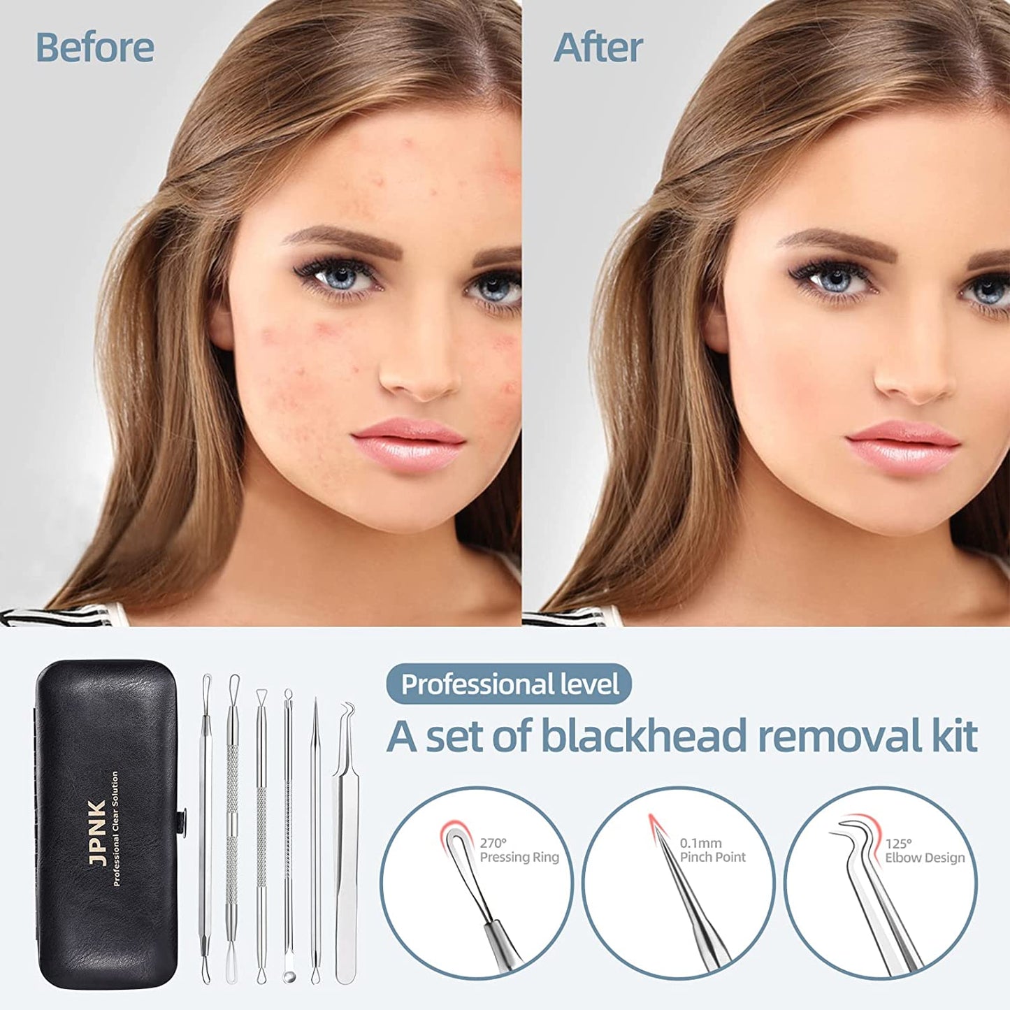 JPNK Blackhead Remover Tool Comedones Extractor Acne Removal Kit for Blemish, Whitehead Popping, 6 Pcs Zit Removing for Nose Face Tools with a Leather Bag Health & Beauty > Personal Care > Cosmetics > Cosmetic Tools > Skin Care Tools JPNK   