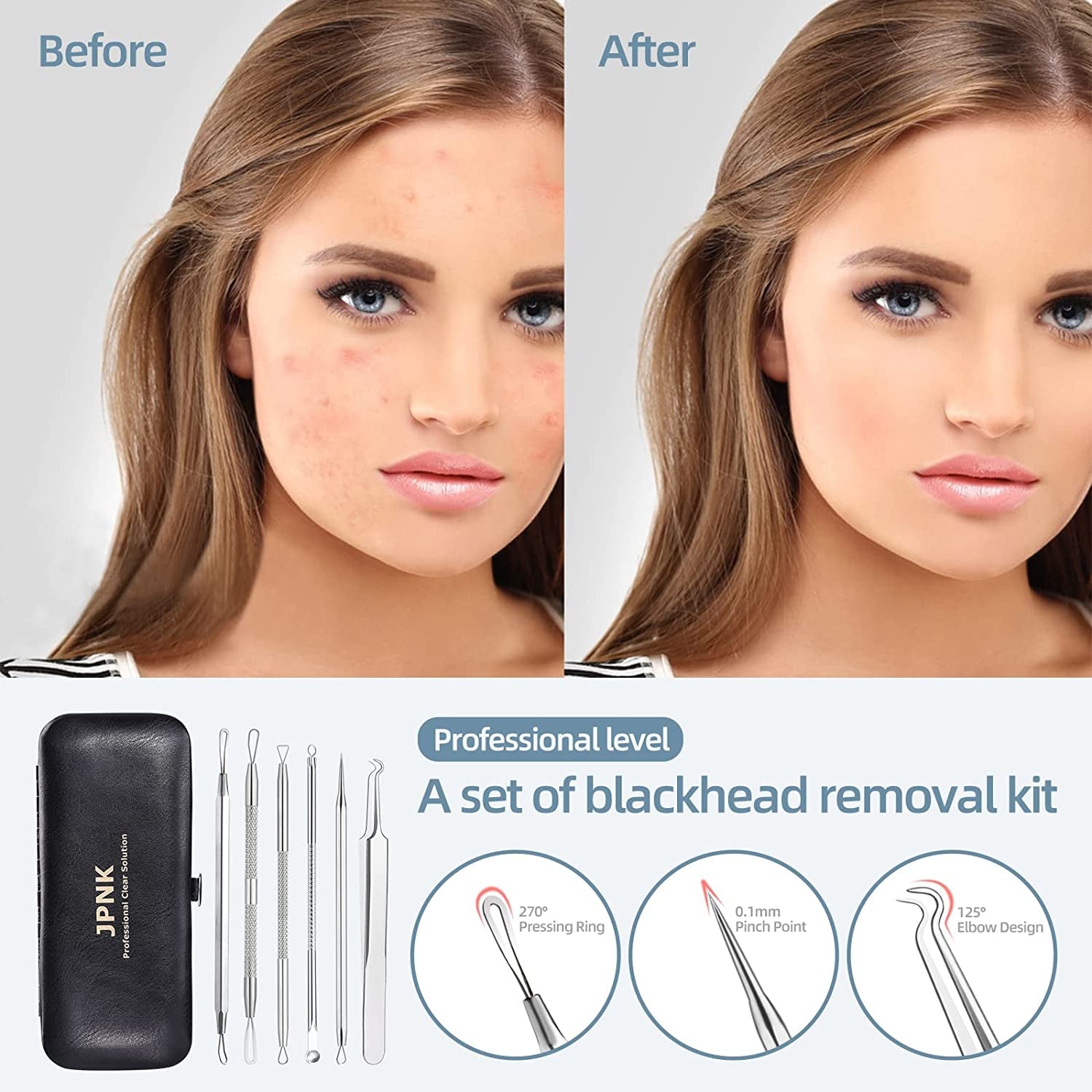 JPNK Blackhead Remover Tool Comedones Extractor Acne Removal Kit for Blemish, Whitehead Popping, 6 Pcs Zit Removing for Nose Face Tools with a Leather Bag Health & Beauty > Personal Care > Cosmetics > Cosmetic Tools > Skin Care Tools JPNK   