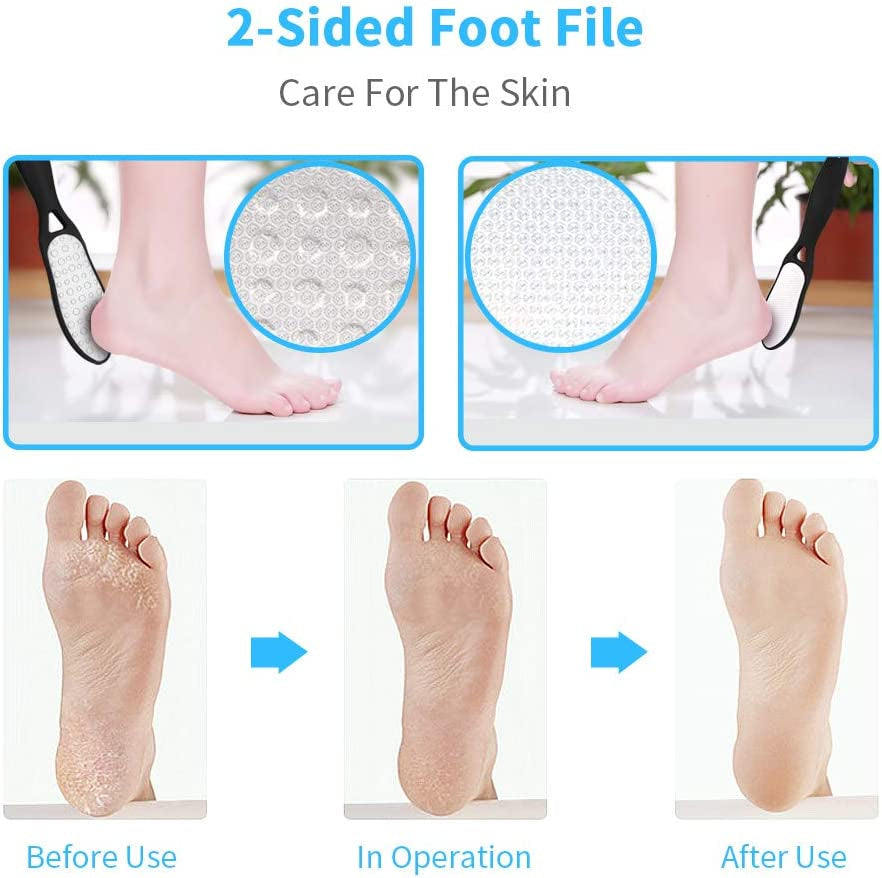 Professional Pedicure Kit SOFYE Foot Files Set Tools Double Sided Files Exfoliating Prevent Dead Skin Foot Skin Care Tool Set Salon Pedicure Kit Washable Effectively 13 in 1… Health & Beauty > Personal Care > Foot Care SOFYE   