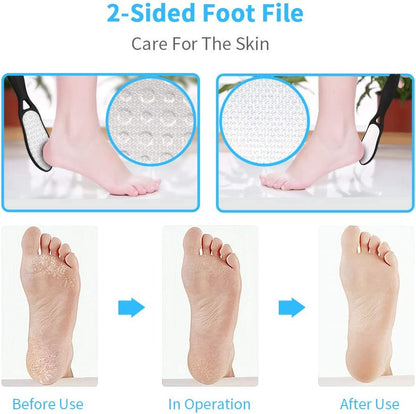 Professional Pedicure Kit SOFYE Foot Files Set Tools Double Sided Files Exfoliating Prevent Dead Skin Foot Skin Care Tool Set Salon Pedicure Kit Washable Effectively 13 in 1… Health & Beauty > Personal Care > Foot Care SOFYE   
