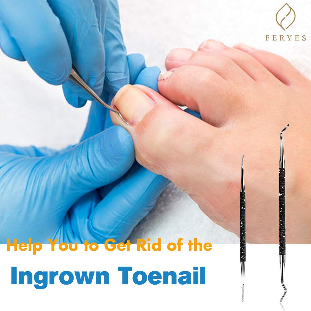 FERYES Ingrown Toenail Tools,Toenail Lifter and Toenail File Set for Ingrown Toenails Treatment - Surgical Grade Stainless Steel under Nail Cleaner Pedicure Tools - W/Tin Storage Box Health & Beauty > Personal Care > Cosmetics > Cosmetic Tools > Nail Tools FERYES   