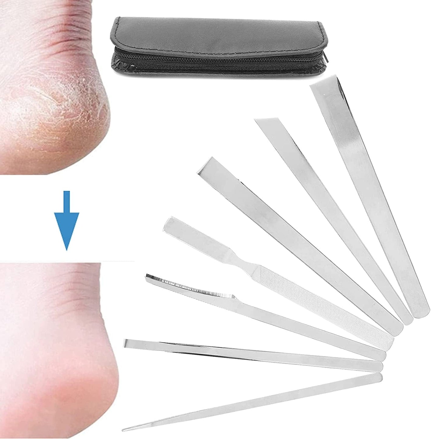 7Pcs Stainless Steel Pedicure File Set, Dead Skin Horny Remover Foot Callus Pedicure Knife Set,Foot File Kit with Storage Bag for Ingrown Foot Fingernail Care Health & Beauty > Personal Care > Foot Care Zyyini   