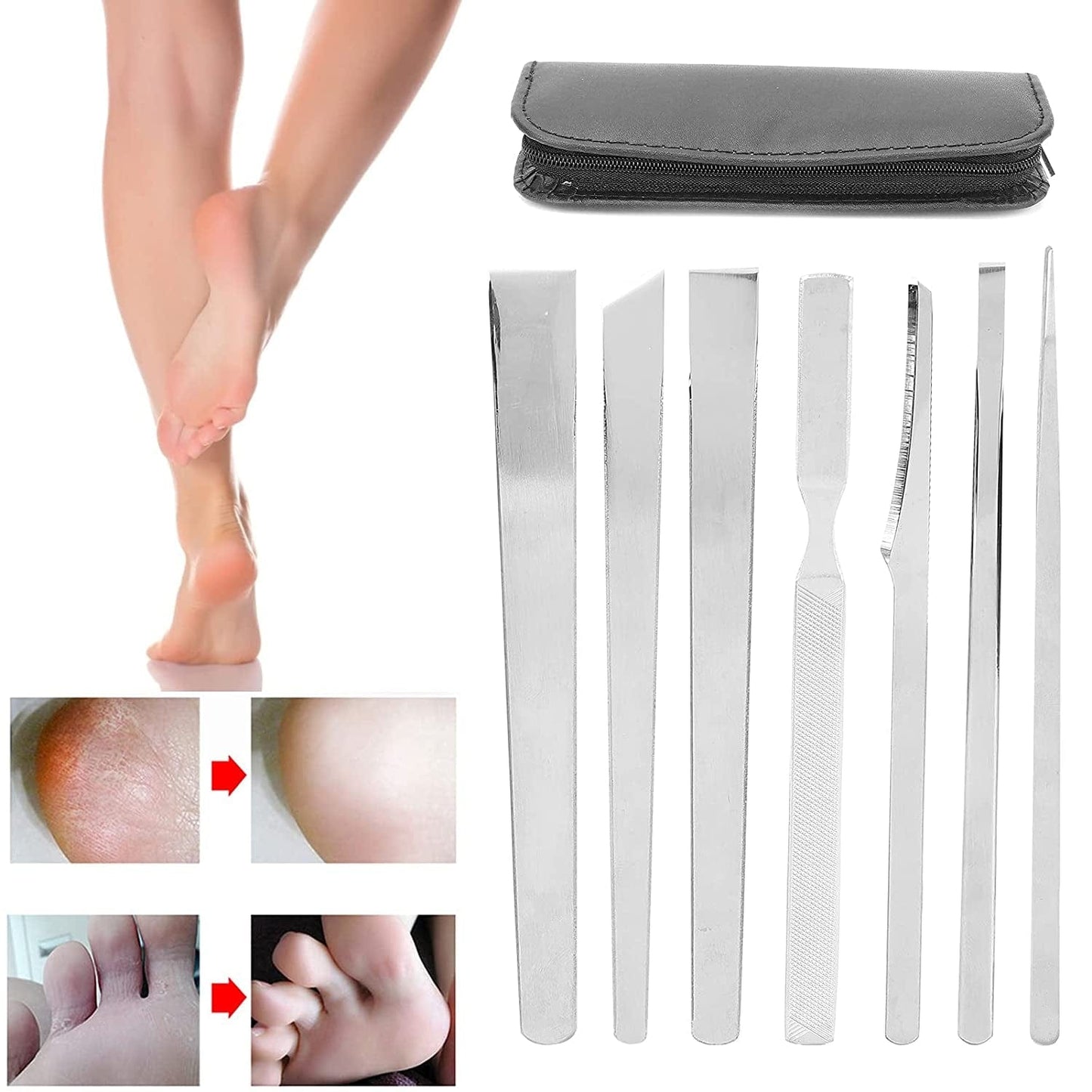7Pcs Stainless Steel Pedicure File Set, Dead Skin Horny Remover Foot Callus Pedicure Knife Set,Foot File Kit with Storage Bag for Ingrown Foot Fingernail Care Health & Beauty > Personal Care > Foot Care Zyyini   