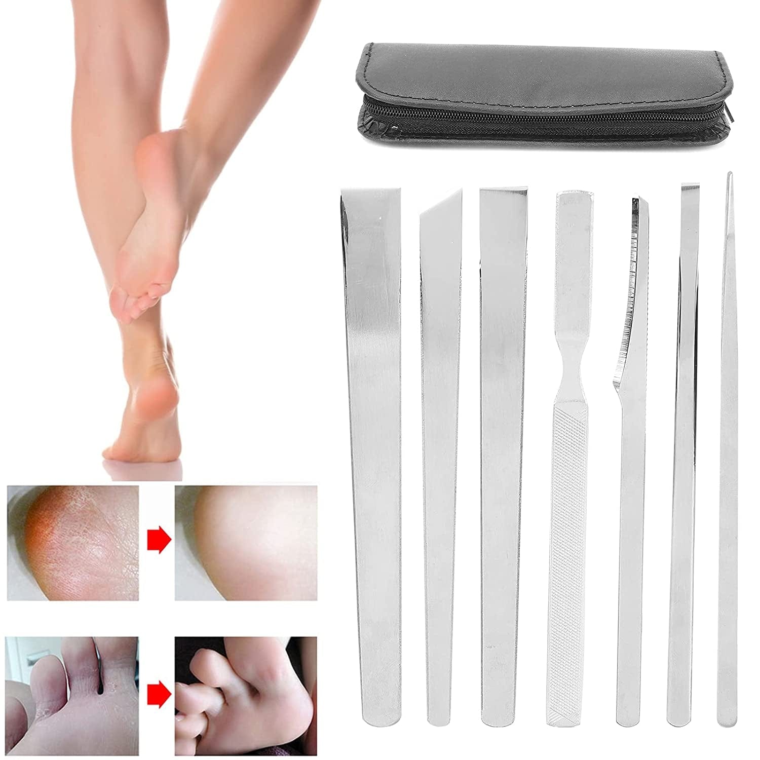 7Pcs Stainless Steel Pedicure File Set, Dead Skin Horny Remover Foot Callus Pedicure Knife Set,Foot File Kit with Storage Bag for Ingrown Foot Fingernail Care Health & Beauty > Personal Care > Foot Care Zyyini   