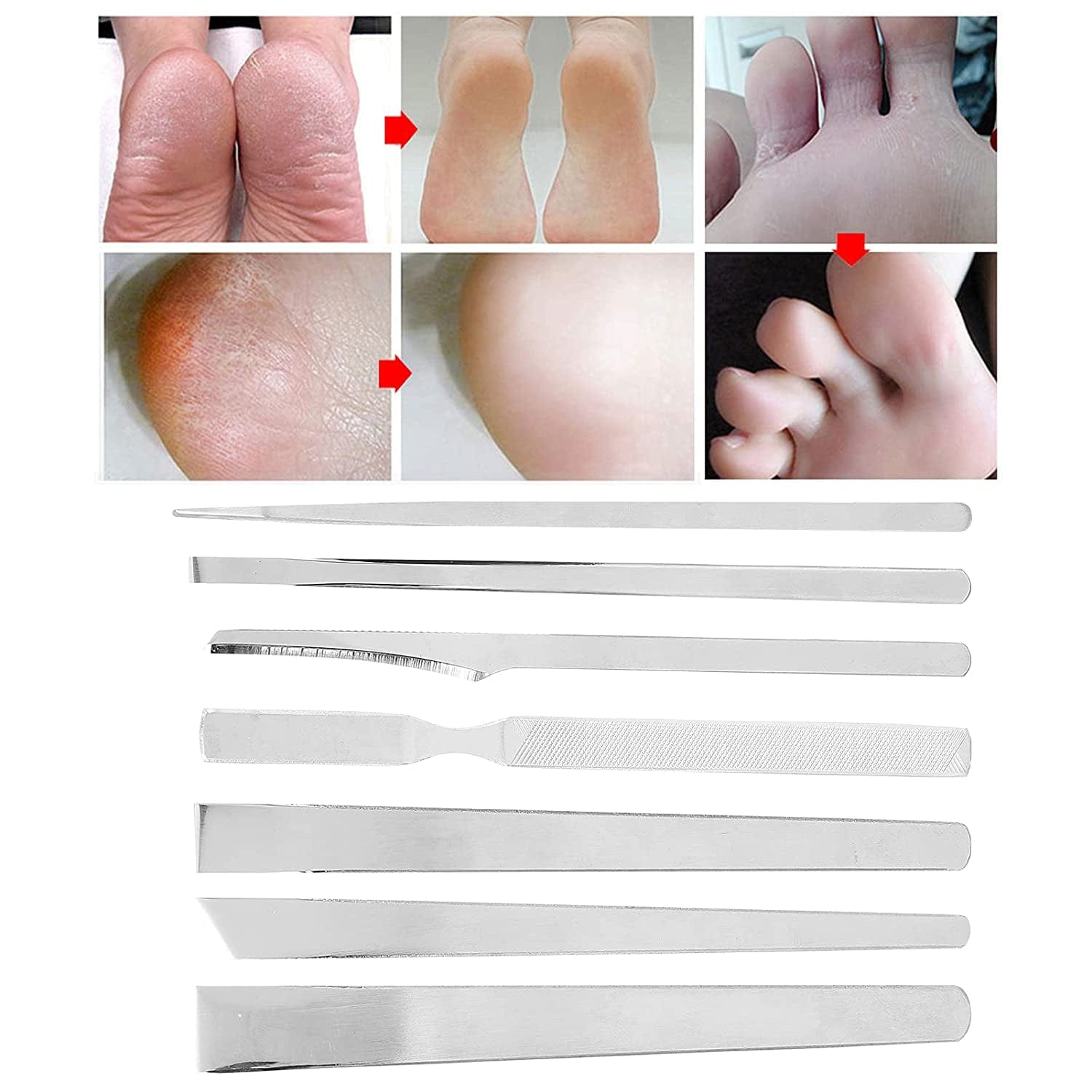 7Pcs Stainless Steel Pedicure File Set, Dead Skin Horny Remover Foot Callus Pedicure Knife Set,Foot File Kit with Storage Bag for Ingrown Foot Fingernail Care Health & Beauty > Personal Care > Foot Care Zyyini   