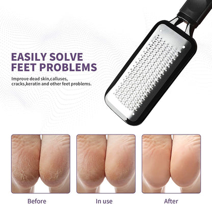 SWEHOME Colossal Professional Feet Care Pedicure Kit Scrubber Foot File and 2 in 1 Pumice Stone for Foot Callus Remover for Rough, Dead Skin Removal, Callus and Daily Feet Care Health & Beauty > Personal Care > Foot Care SWEHOME   