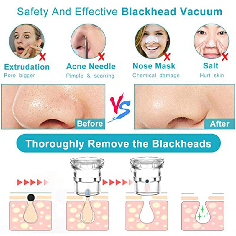 Handsomeface Blackhead Remover, Remover Vacuum Pore Cleaner Electric Suction, Facial Device Acne Comedone Extractor Tool USB with Hot Compress 5 Probes for Nose Face Women Health & Beauty > Personal Care > Cosmetics > Cosmetic Tools > Skin Care Tools Handsomeface   