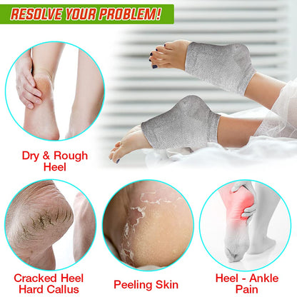 Nado Care Moisturizing Socks Lotion Gel for Dry Cracked Heels - Spa Gel Socks Humectant Moisturizer Heel Balm Foot Care Heel Softener Compression Cotton - 4 Pair Health & Beauty > Personal Care > Foot Care Nado care   