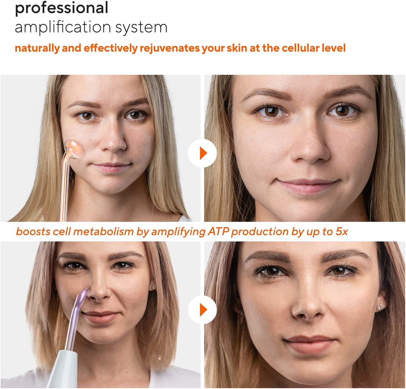Nuderma Professional Skin Therapy Wand - Portable High Frequency Skin Therapy Machine with 6 Neon & Argon Wands – Boost Your Skin – Clear Firm & Tighten Health & Beauty > Personal Care > Cosmetics > Cosmetic Tools > Skin Care Tools Pure Daily Care   