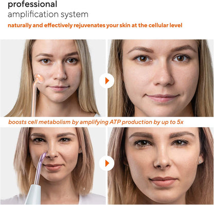 Nuderma Professional Skin Therapy Wand - Portable High Frequency Skin Therapy Machine with 6 Neon & Argon Wands – Boost Your Skin – Clear Firm & Tighten Health & Beauty > Personal Care > Cosmetics > Cosmetic Tools > Skin Care Tools Pure Daily Care   