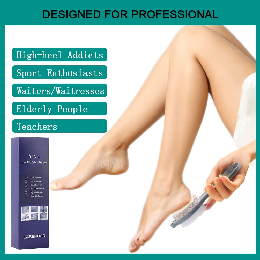 CAREHOOD Foot File Callus Remover - Multi Purpose 4 in 1 Feet Pedicure Tools with Foot Scrubber, Pumice Stone, Foot Rasp and Sand Paper for Home Foot Care (Grey Pedicure Foot File) Health & Beauty > Personal Care > Foot Care CAREHOOD   