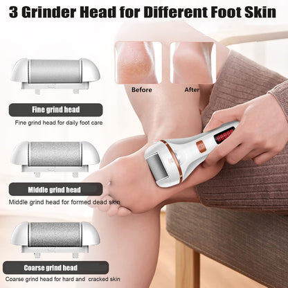 Electric Callus Remover for Feet, Rechargeable Foot Callus Remover Electric Pedicure Foot File, Foot Scrubber Dead Skin Remover Foot Care Kit Professional Pedicure Tools with 2 Speed/Lcd Display Health & Beauty > Personal Care > Foot Care AOMEES   