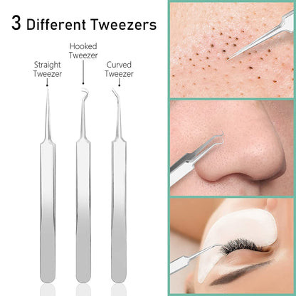 Blackhead Remover Pimple Popper Tool Kit Acne Blemish Pimple Extractor Needle Facial Comedone Clip Blackhead Tweezer for Ingrown Hair Removal 8 Pcs in Metal Case Health & Beauty > Personal Care > Cosmetics > Cosmetic Tools > Skin Care Tools Dr.Pedi   