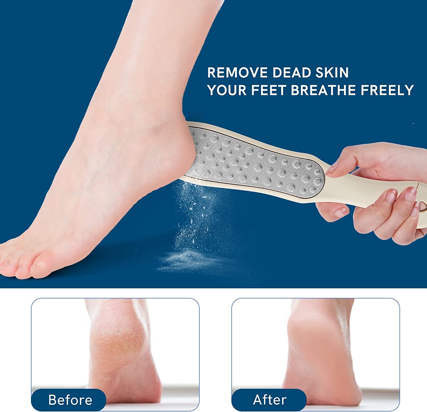 Foot Filer Dead Skin, Double Sided Foot Scraper Wet/ Dry Use, Foot Rasp for Cracked Heel and Foot Corn Removal, Portable Foot Care Tool, Pedicure File, Orange Health & Beauty > Personal Care > Foot Care Cut it   