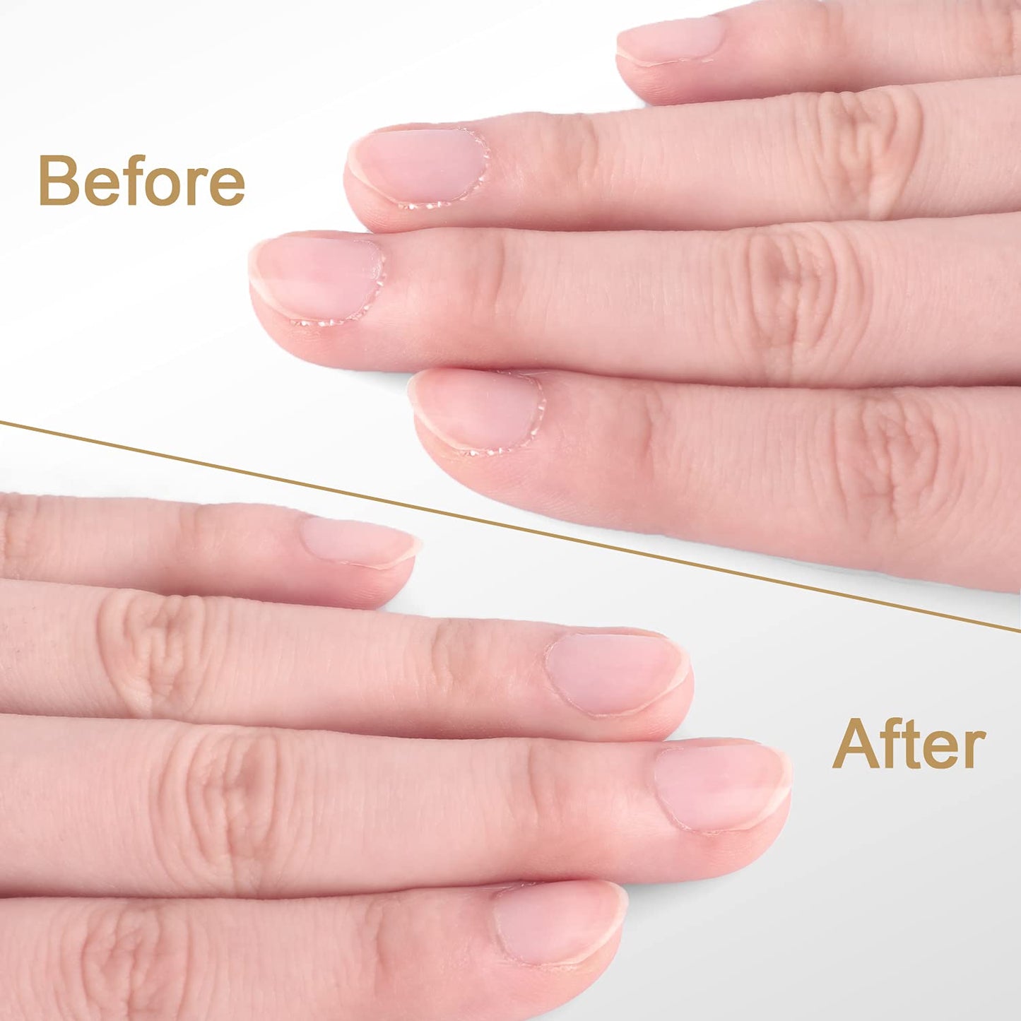 Cuticle Trimmer with Cuticle Pusher, Easkep Cuticle Remover Cuticle Nipper Professional Stainless Steel Cuticle Cutter Clipper Pedicure Manicure Tools for Fingernails and Toenails (D501-Black) Health & Beauty > Personal Care > Cosmetics > Cosmetic Tools > Nail Tools Easkep   