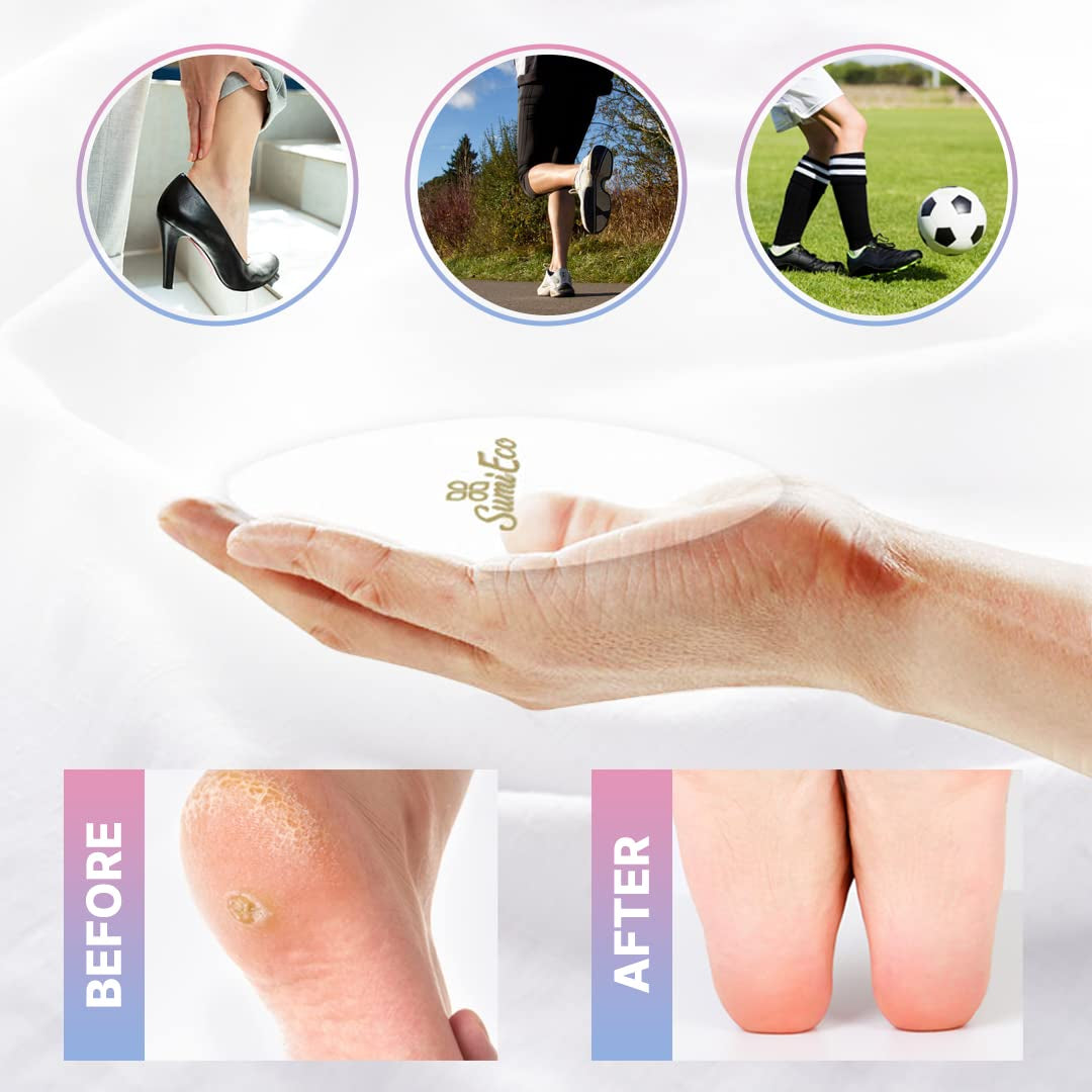 Colossal Innovative Nano Glass Callus Remover Foot File - Coarse Foot Rasp Colossal Foot Scrubber Salon Home Pedicure Foot Care Tool for Soft Feet (1PC) Health & Beauty > Personal Care > Foot Care SUMI ECO ECO-FRIENDLY   