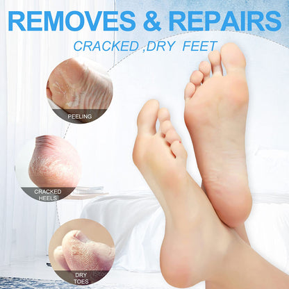 Foot Spa Pedicure Set, Home Foot Soak with Bath Salt, Foot Cream, Foot Scrubs, 4 in 1 Exfoliating Foot Care for Dry Cracked Feet, Make Baby Soft Feet Health & Beauty > Personal Care > Foot Care nbc BeautiLab   