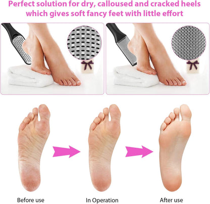 Professional Pedicure Kit 20 in 1, UOWGA Stainless Steel Foot Rasp Foot Peel and Callus Clean Feet Dead Skin Tool Set Nail Clipper Included - Self Care Gifts for Women Health & Beauty > Personal Care > Foot Care UOWGA   
