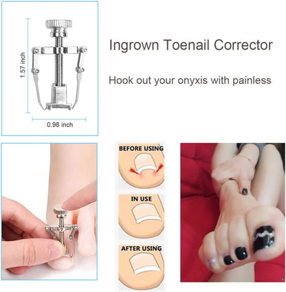 Bcabo Upgraded 8Pcs/Set Ingrown Toenail Tools Kit, Premium Nail Treatment Foot Tool, Ingrown Toenail Removal Correction Clippers, Surgery Grade Ingrown Toe Nail File Lifter, Professional Pedicure Tool Health & Beauty > Personal Care > Cosmetics > Cosmetic Tools > Nail Tools Bcabo   