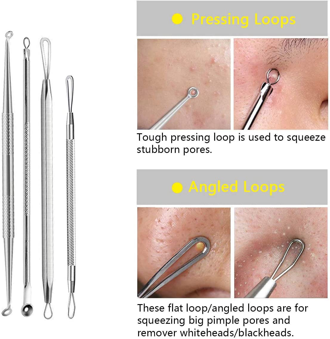 Pimple Popper Tool Kit Blackhead Tweezer, Aooeou Acne Removal Comedone Extractor Kit Pimple Tweezers for Pimples, Blackheads, Blemish, Whitehead, Zit Removing for Forehead Nose Facial Pore Health & Beauty > Personal Care > Cosmetics > Cosmetic Tools > Skin Care Tools Aooeou   