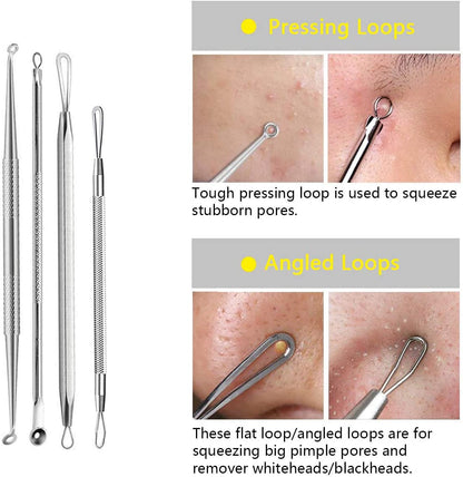 Pimple Popper Tool Kit Blackhead Tweezer, Aooeou Acne Removal Comedone Extractor Kit Pimple Tweezers for Pimples, Blackheads, Blemish, Whitehead, Zit Removing for Forehead Nose Facial Pore Health & Beauty > Personal Care > Cosmetics > Cosmetic Tools > Skin Care Tools Aooeou   