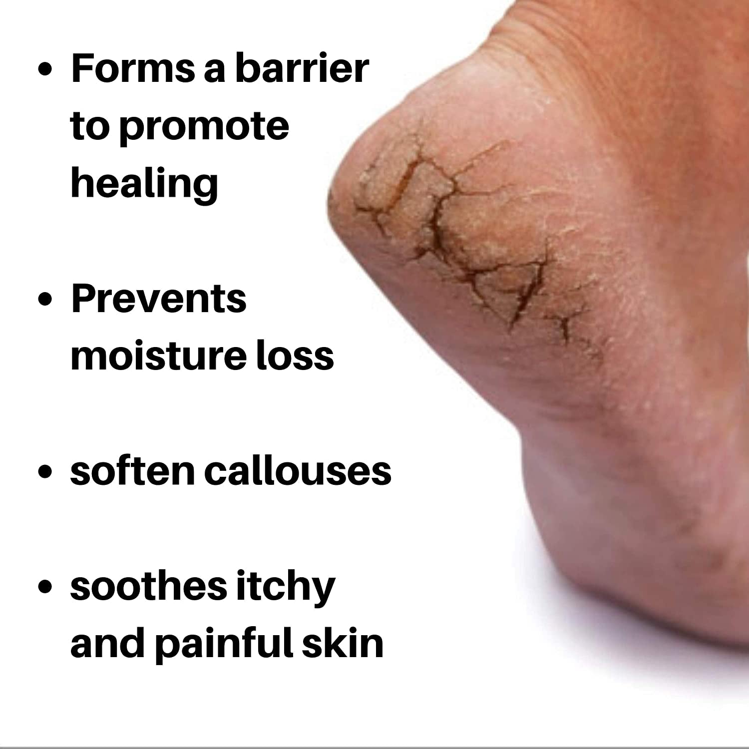 Nordic Care Foot Care Cream with 10% Urea to Treat Dry Skin and Repair Cracked Heels 6Oz Health & Beauty > Personal Care > Foot Care Nordic Care   