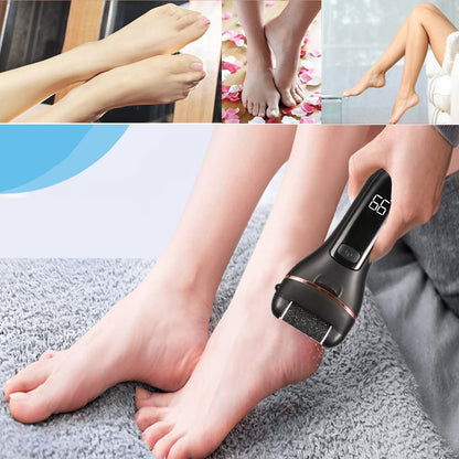 Electric Callus Remover for Feet, Rechargeable Foot Callus Remover Pedicure Tools Foot File, Professional Pedicure Kit Feet Care for Dead,Hard Cracked Dry Skin with 6 Grinding Heads,2Speed,Lcd Display Health & Beauty > Personal Care > Foot Care Aibixile   