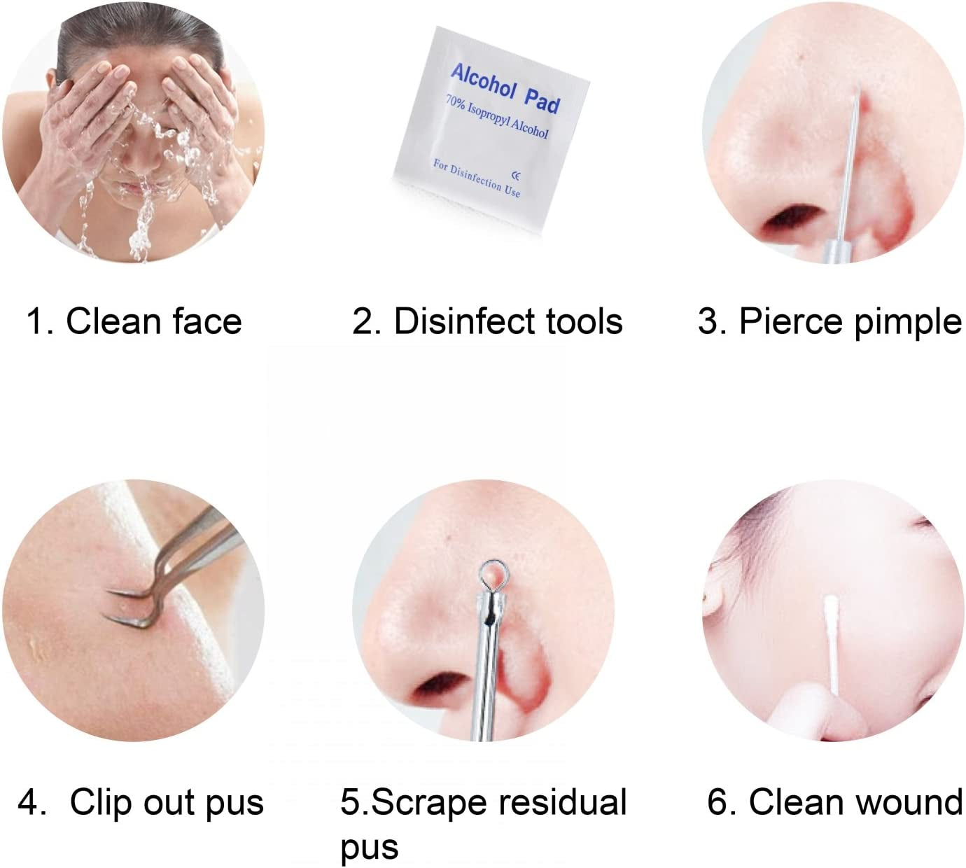 FIXBODY Blackhead and Splinter Remover Tools - Stainless Steel Professional Easily Cure Pimples Whiteheads Comedones Acne Zit Ingrown Hairs and Facial Impurities Bend Head Tweezer Surgical Kit Health & Beauty > Personal Care > Cosmetics > Cosmetic Tools > Skin Care Tools FIXBODY   