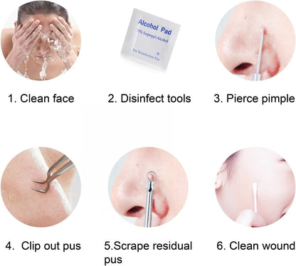 FIXBODY Blackhead and Splinter Remover Tools - Stainless Steel Professional Easily Cure Pimples Whiteheads Comedones Acne Zit Ingrown Hairs and Facial Impurities Bend Head Tweezer Surgical Kit Health & Beauty > Personal Care > Cosmetics > Cosmetic Tools > Skin Care Tools FIXBODY   