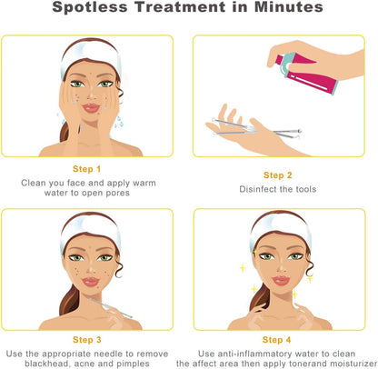 Vamotto Pimple Popper Tool Kit -10 Pcs Blackhead Remover Comedone Extractor Kit Blemish Remover for Acne Removal Kit for Whitehead Popping Zit Removing for Nose Face Tools with a Leather Bag Health & Beauty > Personal Care > Cosmetics > Cosmetic Tools > Skin Care Tools Boolink   
