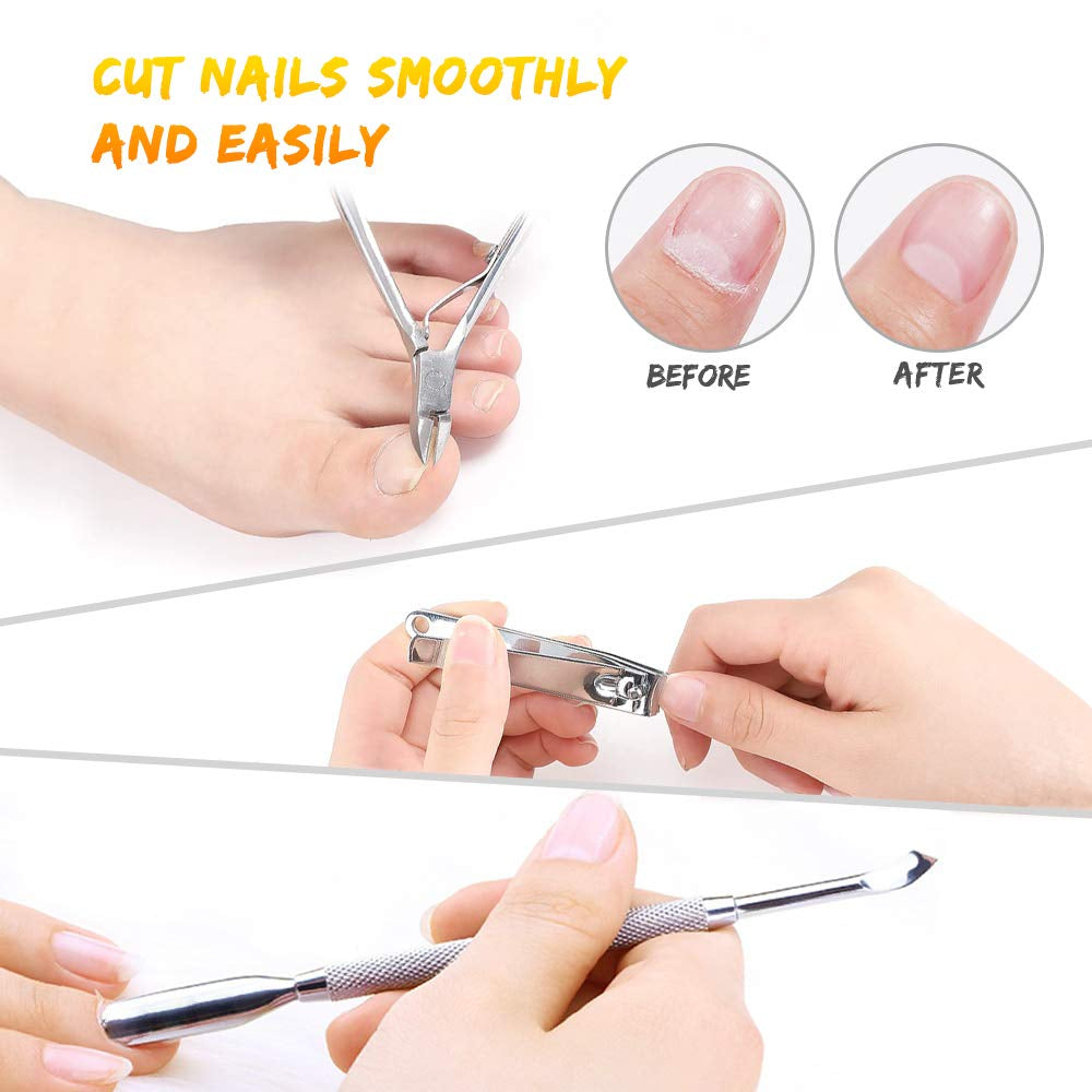 Pedicure Kit for Women, 20 in 1 Foot Care Pedicure Kit Stainless Steel, Foot Files Set with Nail Scrub Double Sided Files Foot Care for Women, Men, Home and Salon Health & Beauty > Personal Care > Foot Care LINCEDY   
