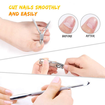 Pedicure Kit for Women, 20 in 1 Foot Care Pedicure Kit Stainless Steel, Foot Files Set with Nail Scrub Double Sided Files Foot Care for Women, Men, Home and Salon Health & Beauty > Personal Care > Foot Care LINCEDY   