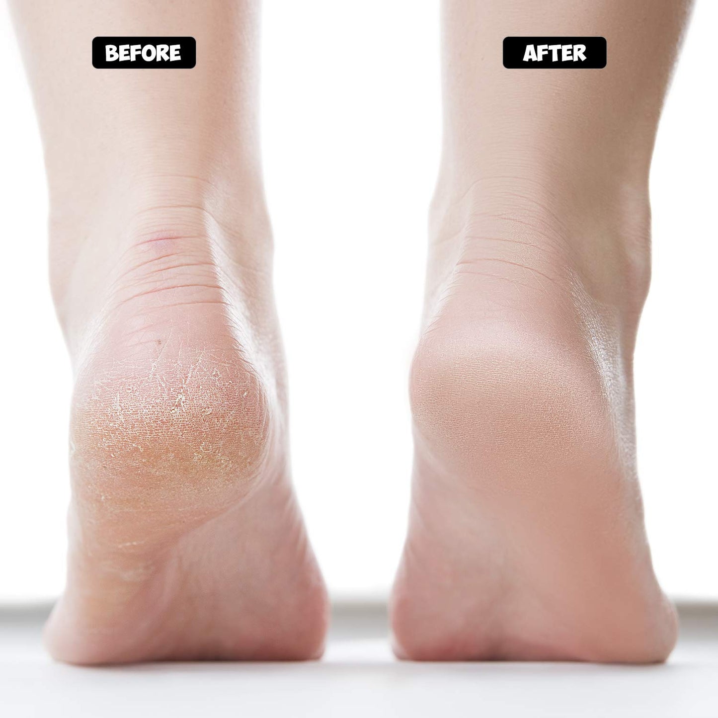 Nado Care Moisturizing Socks Lotion Gel for Dry Cracked Heels - Spa Gel Socks Humectant Moisturizer Heel Balm Foot Care Heel Softener Compression Cotton - 4 Pair Health & Beauty > Personal Care > Foot Care Nado care   