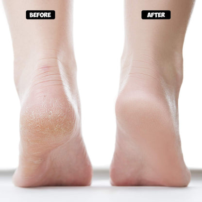 Nado Care Moisturizing Socks Lotion Gel for Dry Cracked Heels - Spa Gel Socks Humectant Moisturizer Heel Balm Foot Care Heel Softener Compression Cotton - 4 Pair Health & Beauty > Personal Care > Foot Care Nado care   