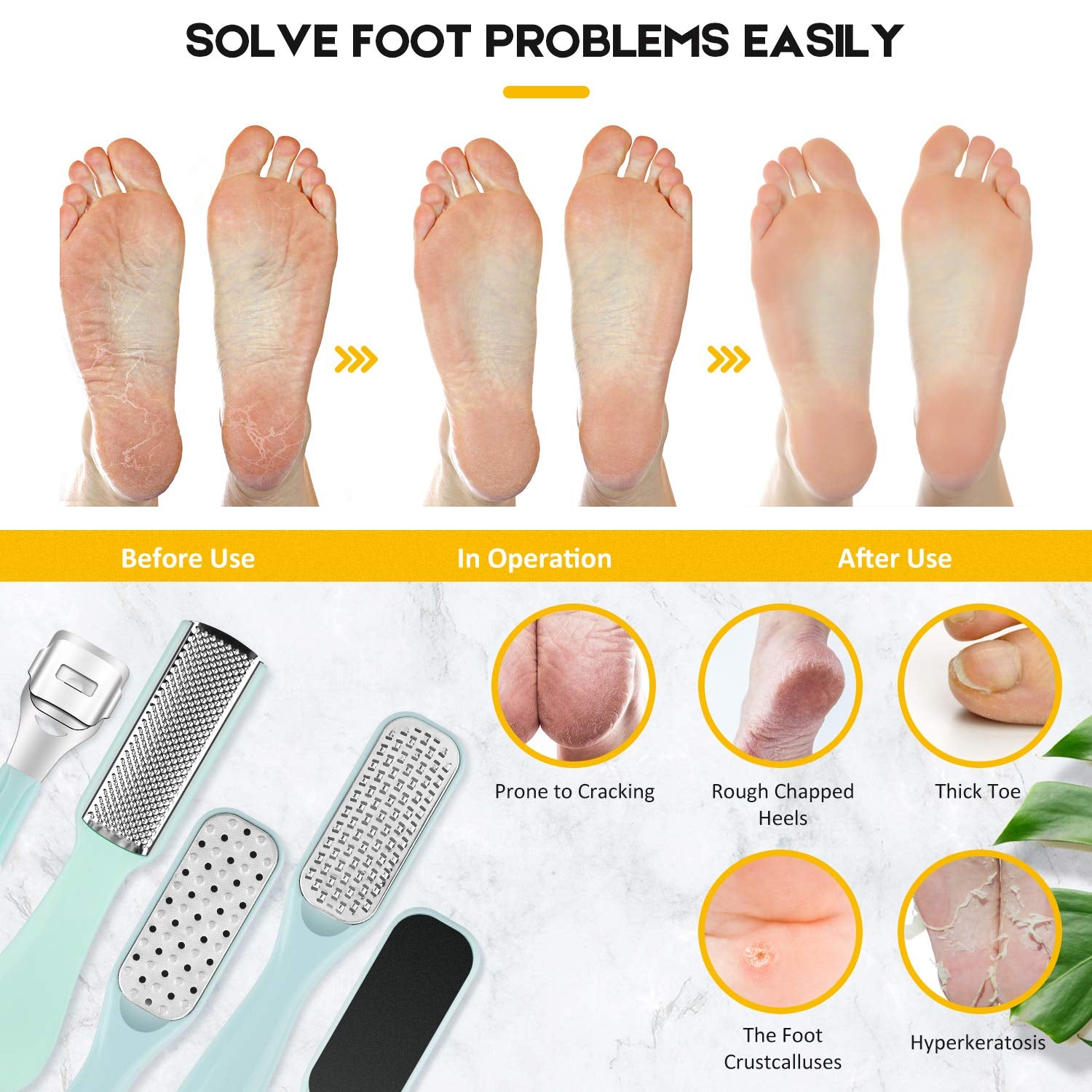 Pedicure Foot File Tools Kit - Professional Feet Corns Callus Remover Shaver Hard Dead Skin Removal Double-Sided Home Professional Wet Dry Use Best Gift for Family Friends Men Women Foot Care Set Health & Beauty > Personal Care > Foot Care soulkoo   