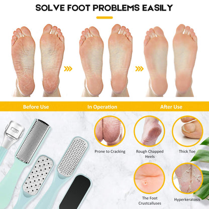 Pedicure Foot File Tools Kit - Professional Feet Corns Callus Remover Shaver Hard Dead Skin Removal Double-Sided Home Professional Wet Dry Use Best Gift for Family Friends Men Women Foot Care Set Health & Beauty > Personal Care > Foot Care soulkoo   