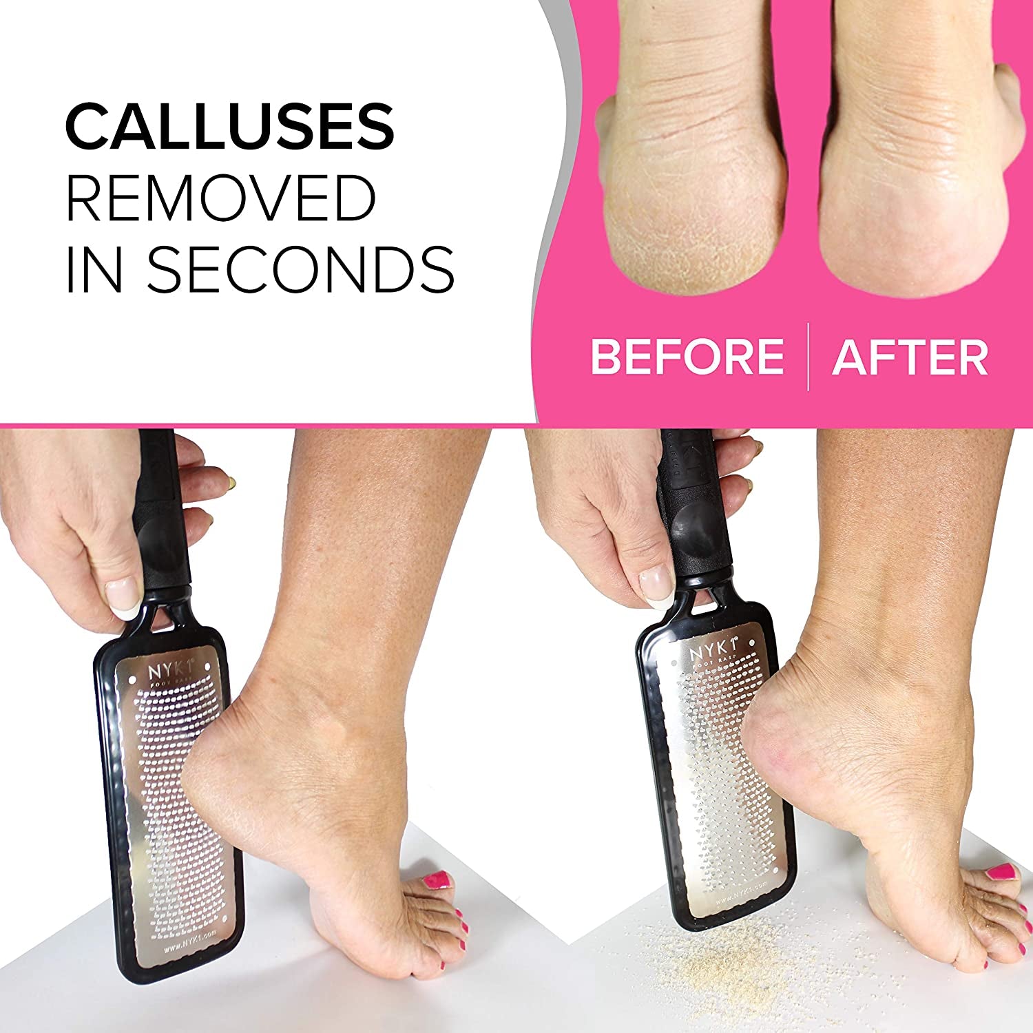 Pedicure Rasp for Dry Hard Skin - BEST SELLING Foot File GENUINE MEGAFILE Heel Care Callus Remover Dry Dead Skin Egg Corn Sander Scrubber Pumice Stone Alternative Ped Pedi Grater Files Add on Item Health & Beauty > Personal Care > Foot Care NYK1   