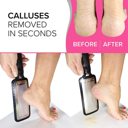 Pedicure Rasp for Dry Hard Skin - BEST SELLING Foot File GENUINE MEGAFILE Heel Care Callus Remover Dry Dead Skin Egg Corn Sander Scrubber Pumice Stone Alternative Ped Pedi Grater Files Add on Item Health & Beauty > Personal Care > Foot Care NYK1   