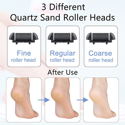 Electric Callus Remover for Feet, Rechargeable Foot File Pedicure Tools,12 in 1 Pedicure Kit for Cracked Heels Calluses Dead Skin,Pedi Foot Scrubber with 3 Roller Heads,2 Speed,Battery Display Health & Beauty > Personal Care > Foot Care SIHOHAN   