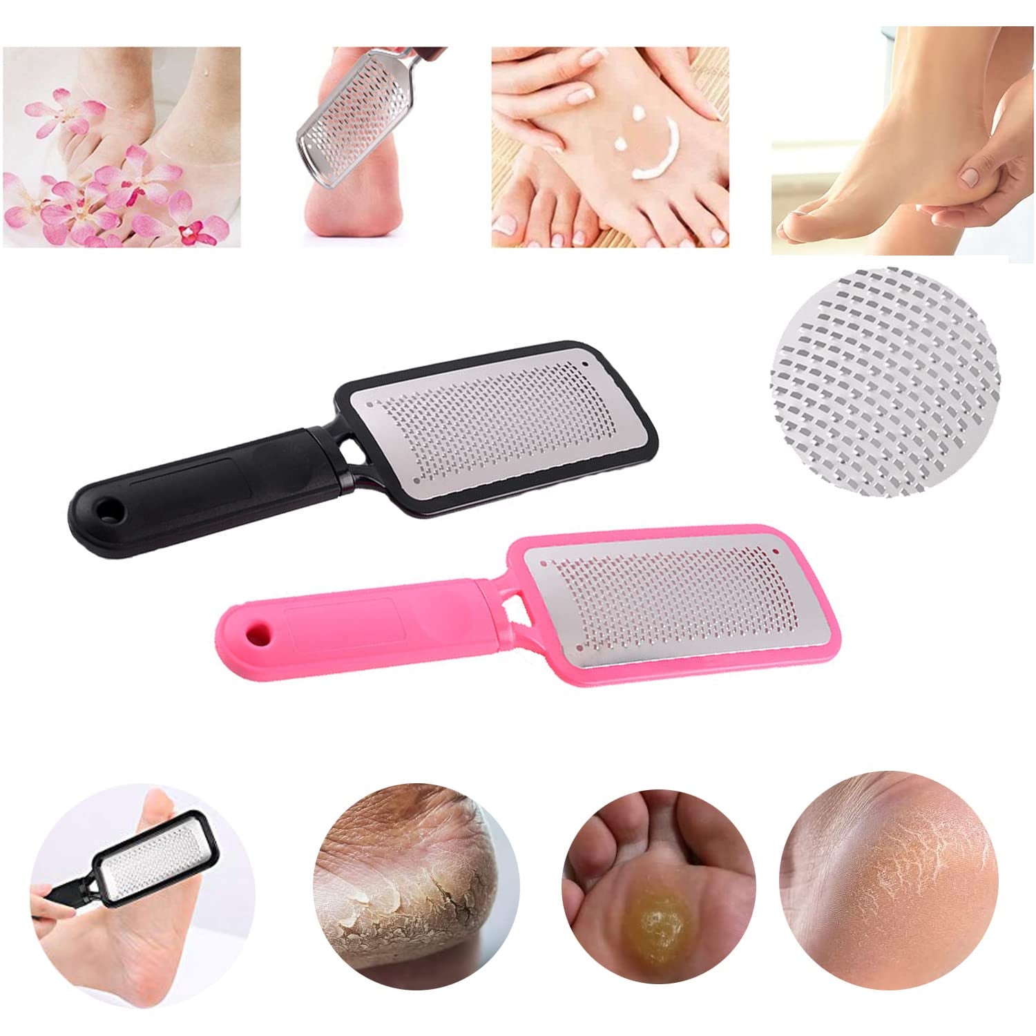 JISTL Foot File Colossal Foot Rasp Stainless Steel Pedicure Metal Surface Foot Care Tool ,Foot Rasp Eliminate Feet Cracked Dead Thick Dry Hard Skin (Pink&10.6") Health & Beauty > Personal Care > Foot Care JISTL   