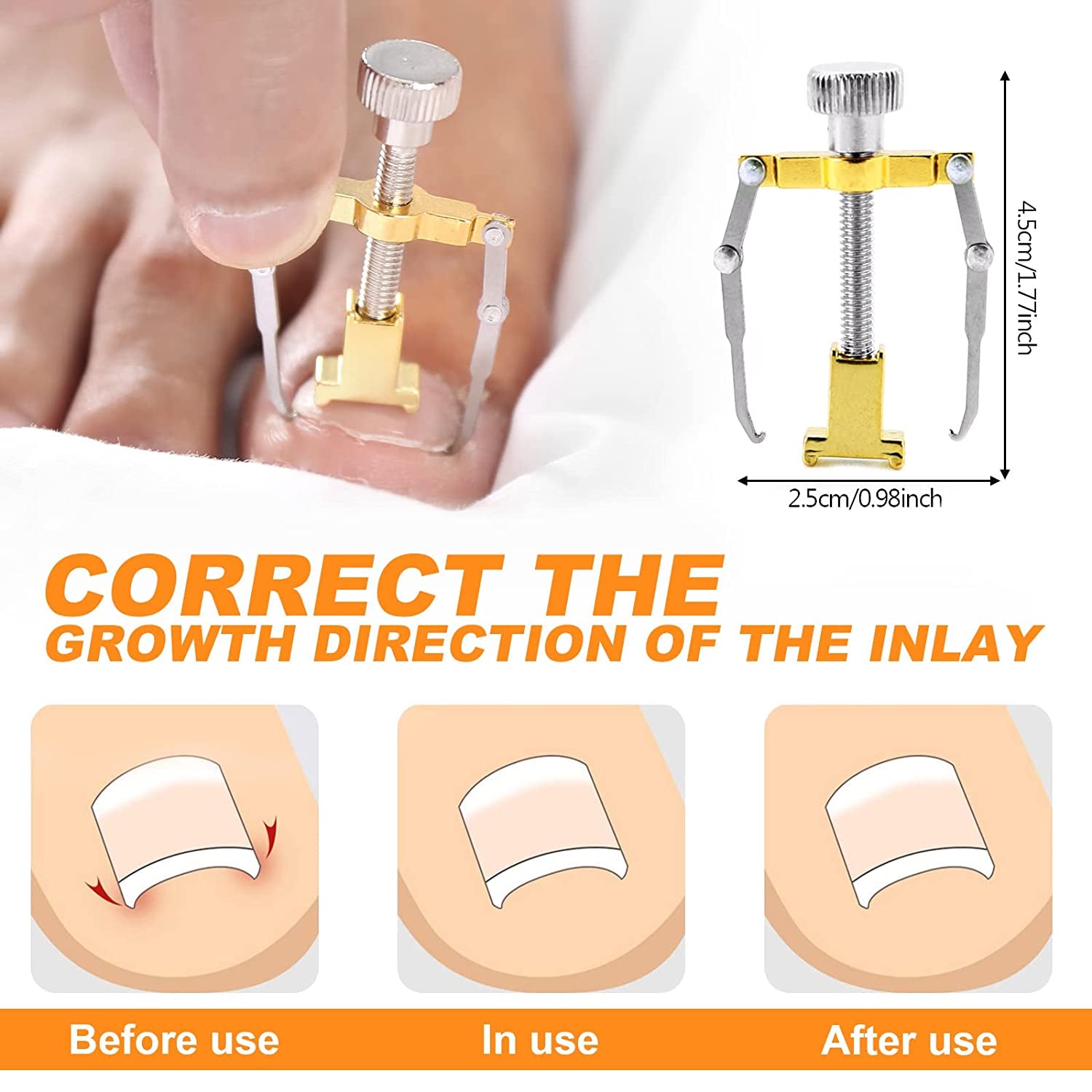Ingrown Toenail Tool, Nail Clippers for Thick Nails, 5Pcs Toe Nail Clippers Treatment Tool for Thick Nails, Stainless Steel Toenails Trimmer and Professional Podiatrist Toenail Removal Kit Health & Beauty > Personal Care > Cosmetics > Cosmetic Tools > Nail Tools Mintiml   