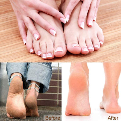 Adampark 23 in 1Pedicure Kit,Professional Pedicure Tools Set for Foot Clean Care,Nail Clippers Foot File Callus Remover Scraper Rasp Care Kits, Cuticle Care Kits for Women, Men, Salon,Home Health & Beauty > Personal Care > Foot Care AdamPark   
