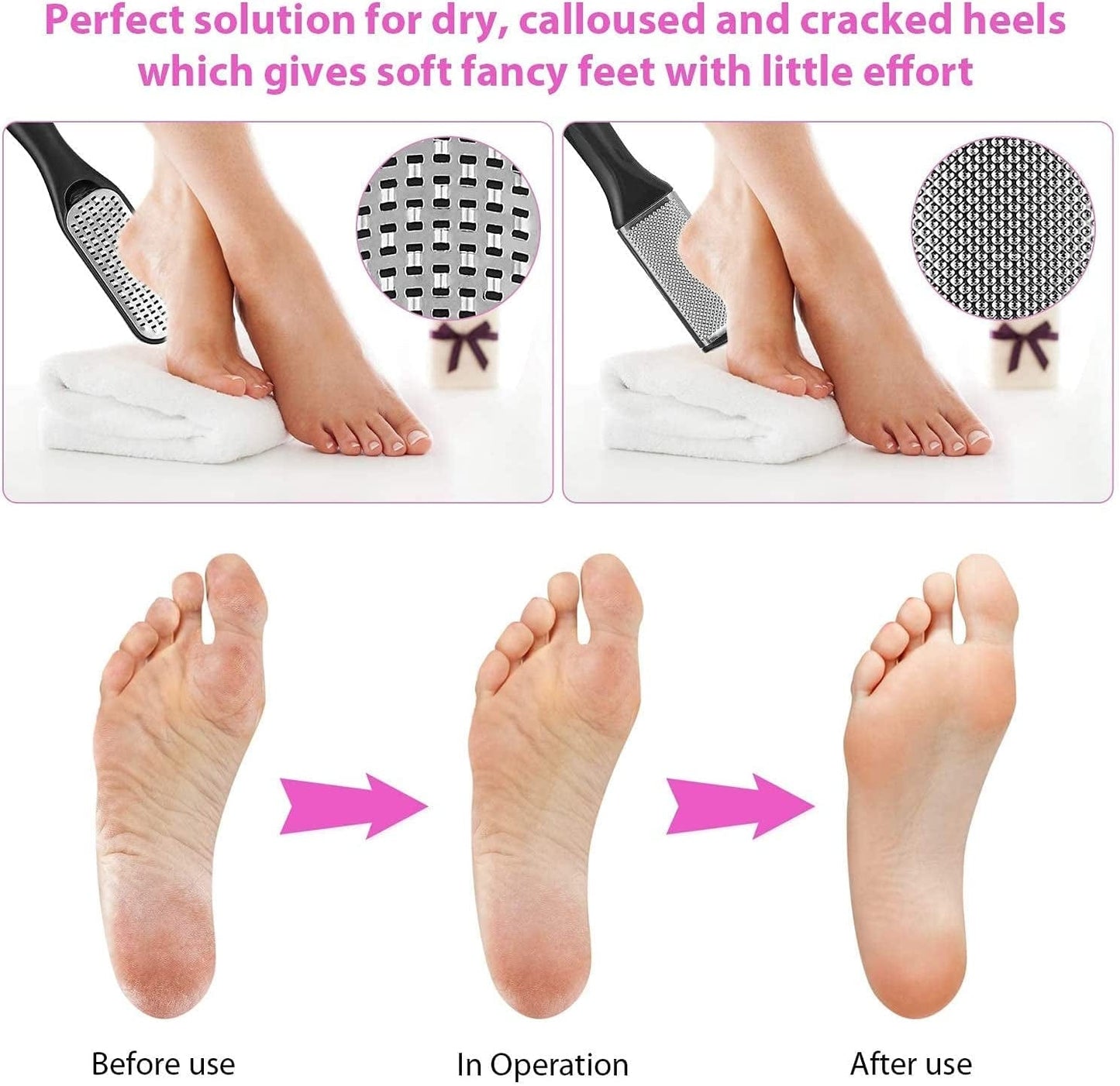 Adamstar 23 in 1 Professional Pedicure Kit for Men Women, Foot Care Pedicure Tools Set, Foot File Callus Remover, Toenail Clipper Foot Scrubber, Foot Rasp Dead Skin Foot Spa Kit at Home, Salon Health & Beauty > Personal Care > Foot Care AdamStar   